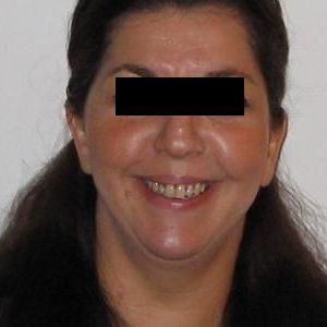 40 jarige Vrouw zoekt Man in Rotterdam (Zuid-Holland)